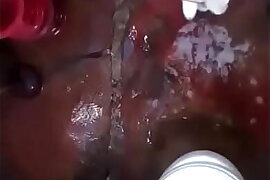 Cama oculta en el ba&ntilde_o
